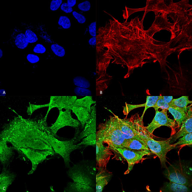 Notch1 Antibody in Immunocytochemistry (ICC/IF)