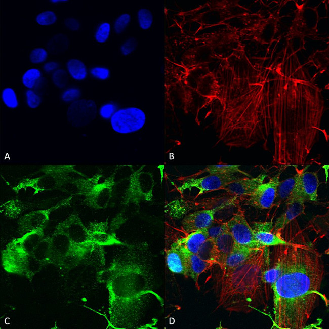 GluA1/GluR1 Antibody in Immunocytochemistry (ICC/IF)