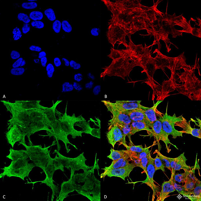 GluA1/GluR1 Antibody in Immunocytochemistry (ICC/IF)