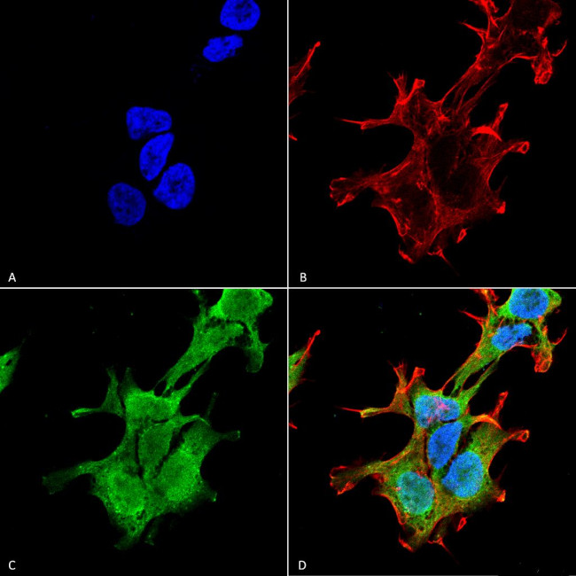 PINK1 Antibody in Immunocytochemistry (ICC/IF)