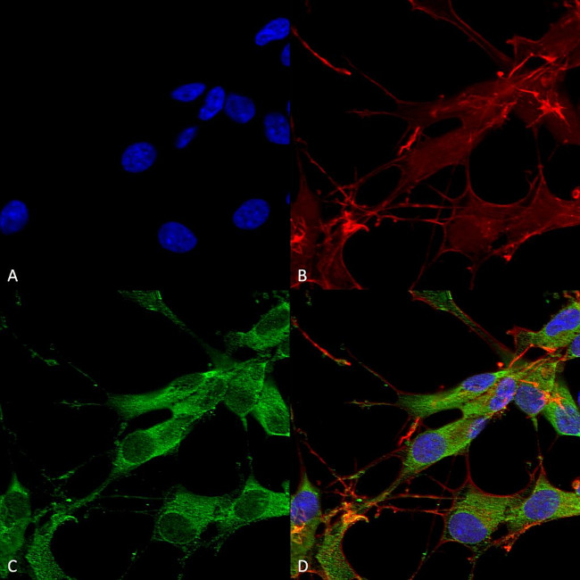 LRRK2/Dardarin Antibody in Immunocytochemistry (ICC/IF)