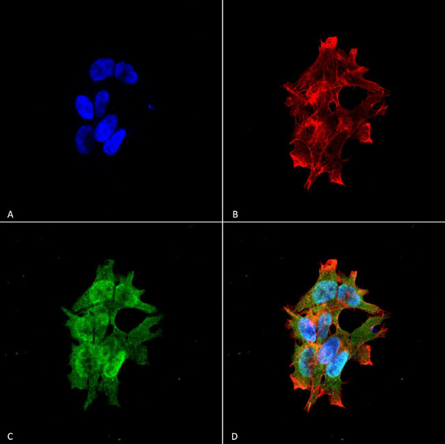 LRRK2/Dardarin Antibody in Immunocytochemistry (ICC/IF)