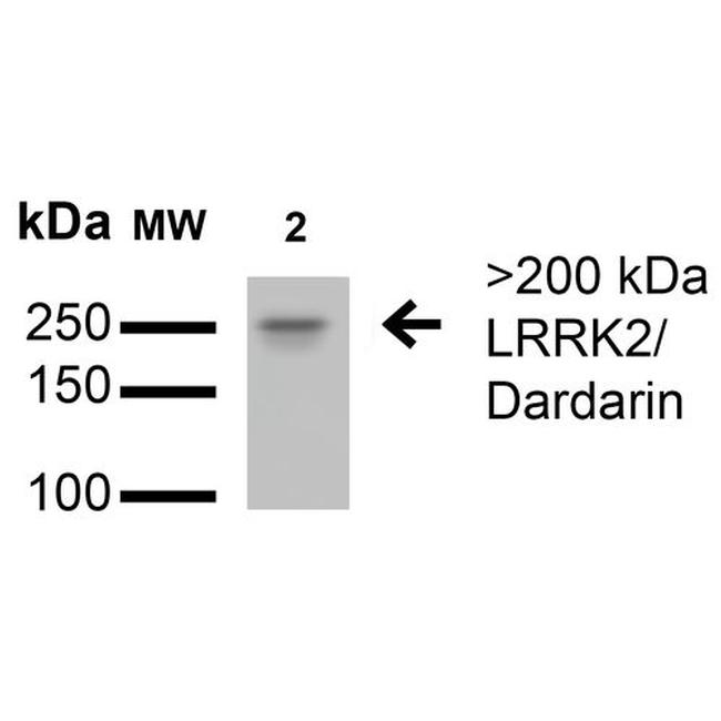 LRRK2/Dardarin Antibody in Western Blot (WB)