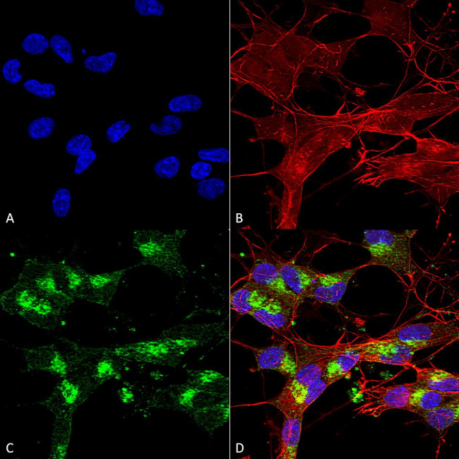 VDAC1 Antibody in Immunocytochemistry (ICC/IF)