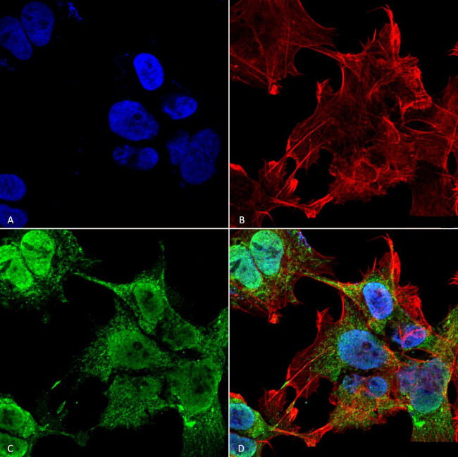 VDAC1 Antibody in Immunocytochemistry (ICC/IF)