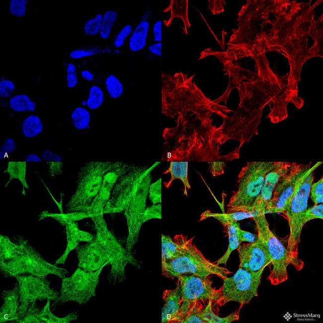 GABARAP Antibody in Immunocytochemistry (ICC/IF)