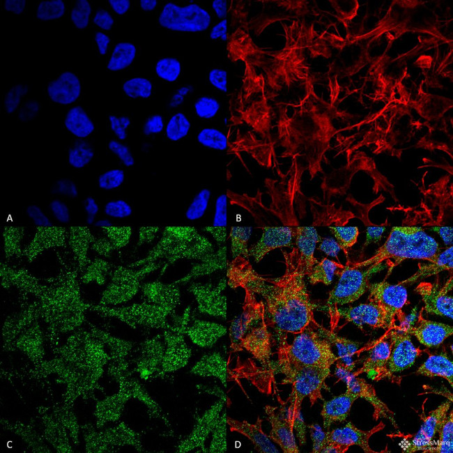 BDNF Antibody in Immunocytochemistry (ICC/IF)