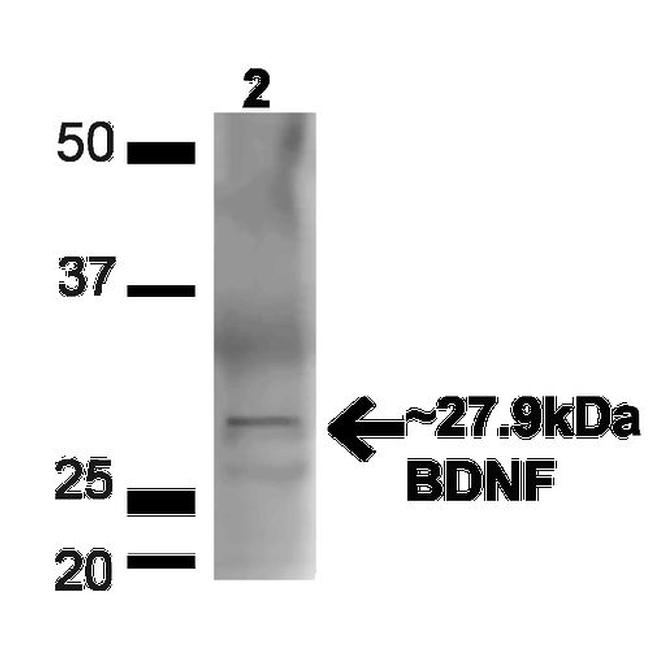 BDNF Antibody in Western Blot (WB)