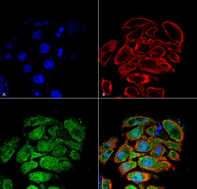 Glucose transporter 2 Antibody in Immunocytochemistry (ICC/IF)