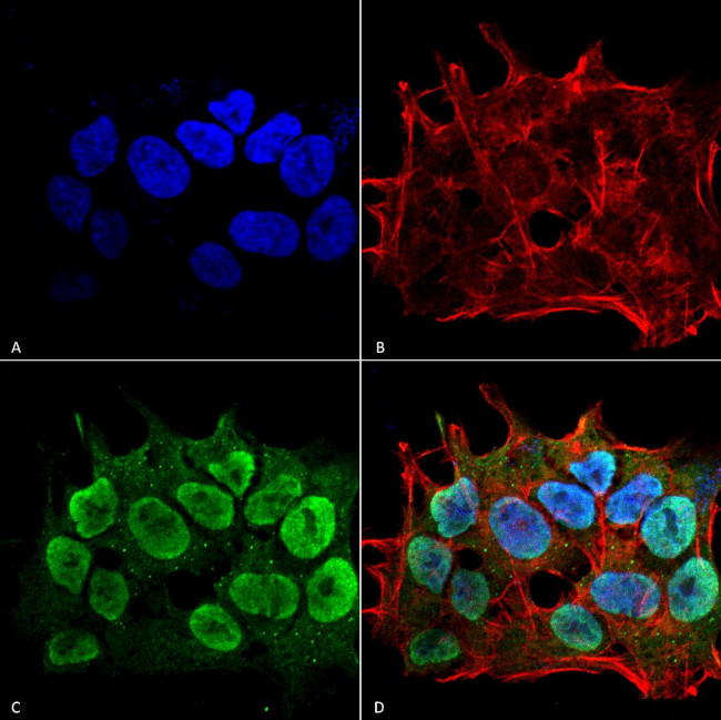 SHANK1/SHANK3 Antibody in Immunocytochemistry (ICC/IF)