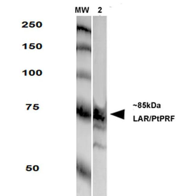 Protein Tyrosine phosphatase Receptor F (PTPRF) Antibody in Western Blot (WB)