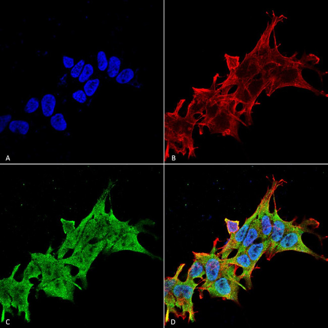 Leucine-Rich Repeat Kinase 2 (LRRK2) Antibody in Immunocytochemistry (ICC/IF)