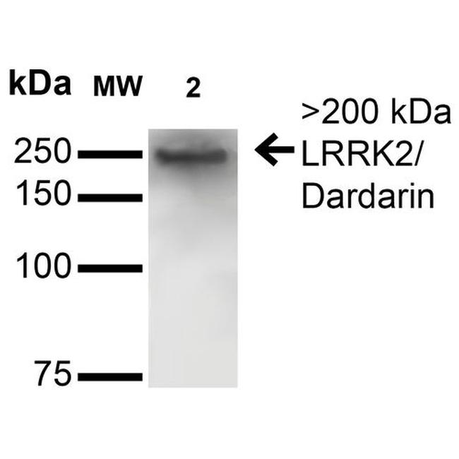Leucine-Rich Repeat Kinase 2 (LRRK2) Antibody in Western Blot (WB)