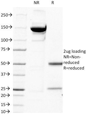 Beta-2 Microglobulin Antibody in Peptide array (ARRAY)