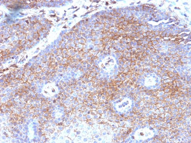 Beta-2 Microglobulin Antibody in Immunohistochemistry (Paraffin) (IHC (P))