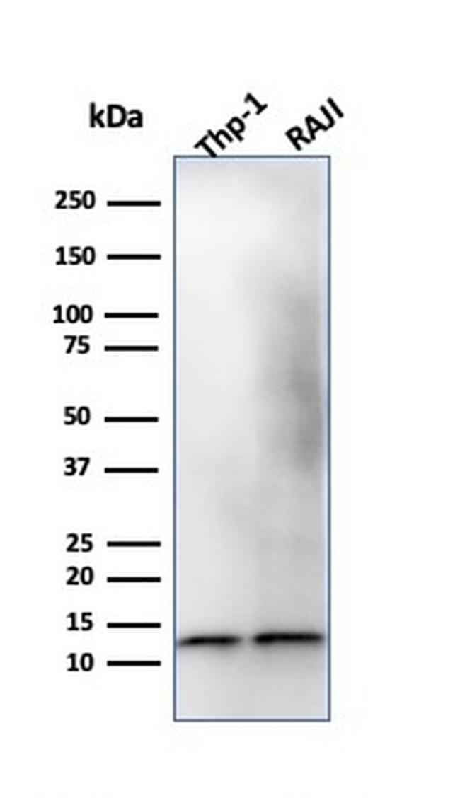 Beta-2 Microglobulin Antibody in Western Blot (WB)