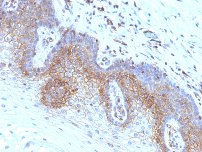 Beta-2 Microglobulin (Renal Failure and Tumor Marker) Antibody in Immunohistochemistry (Paraffin) (IHC (P))