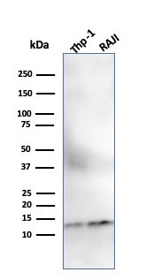 Beta-2 Microglobulin (Renal Failure and Tumor Marker) Antibody in Western Blot (WB)