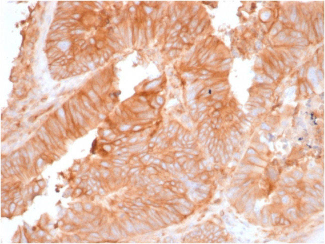 Beta-2 Microglobulin Antibody in Immunohistochemistry (Paraffin) (IHC (P))