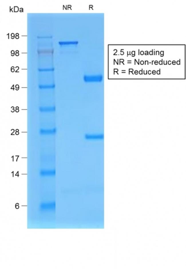 Beta-2 Microglobulin Antibody in SDS-PAGE (SDS-PAGE)