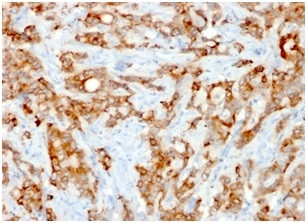 Beta-2 Microglobulin Antibody in Immunohistochemistry (Paraffin) (IHC (P))