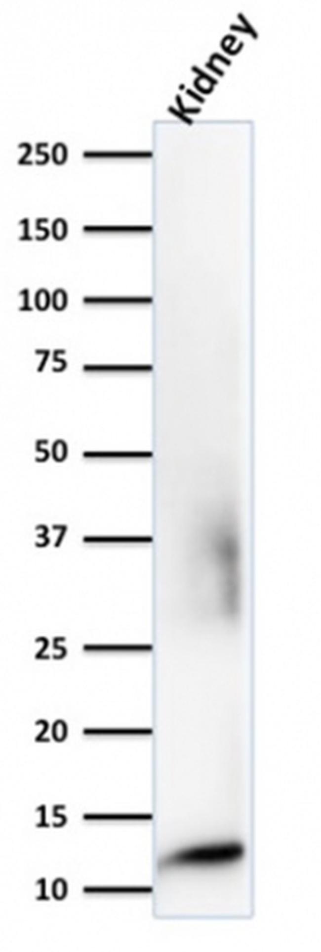 Beta-2 Microglobulin Antibody in Western Blot (WB)