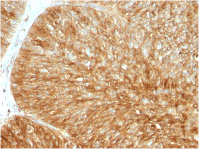 Beta-2 Microglobulin Antibody in Immunohistochemistry (Paraffin) (IHC (P))