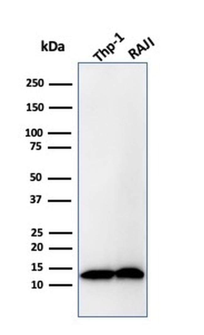 Beta-2 Microglobulin Antibody in Western Blot (WB)