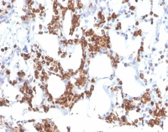 Resistin (RETN) Antibody in Immunohistochemistry (Paraffin) (IHC (P))