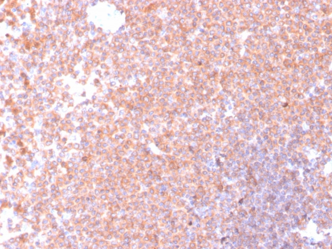 Resistin (RETN) Antibody in Immunohistochemistry (Paraffin) (IHC (P))