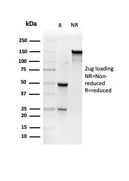 Resistin (RETN) Antibody in SDS-PAGE (SDS-PAGE)