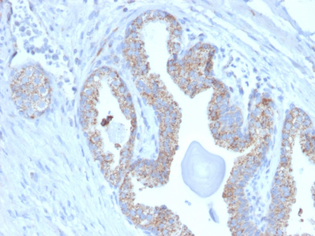 PMEPA1/TMEPAI (Tumor Suppressor Oncoprotein) Antibody in Immunohistochemistry (Paraffin) (IHC (P))