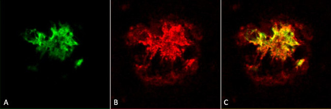 Amyloid Oligomer Antibody in Immunohistochemistry (PFA fixed) (IHC (PFA))