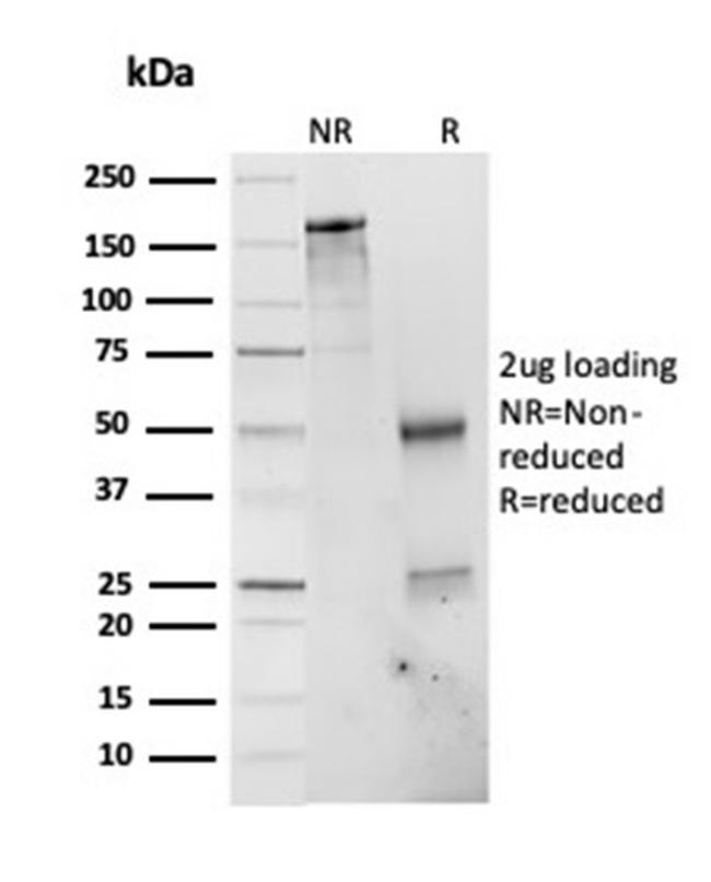 26S proteasome non-ATPase regulatory subunit 4 Antibody in SDS-PAGE (SDS-PAGE)