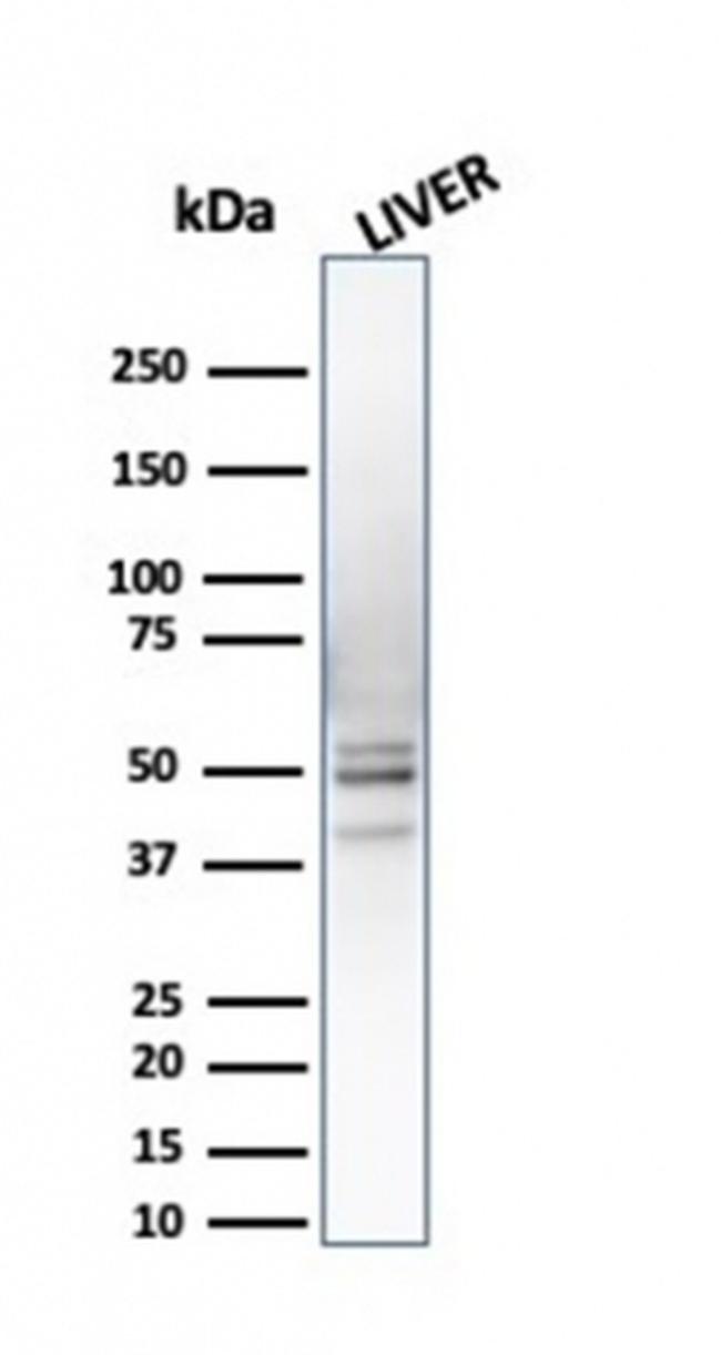 26S proteasome non-ATPase regulatory subunit 4 Antibody in Western Blot (WB)