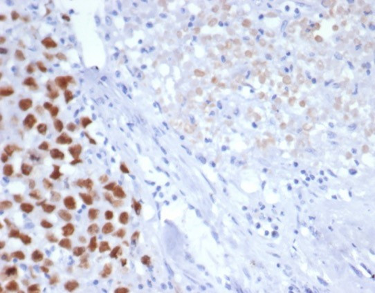 SALL-4 (Transcription Factor) Antibody in Immunohistochemistry (Paraffin) (IHC (P))