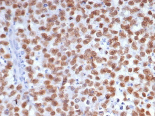 SALL-4 (Transcription Factor) Antibody in Immunohistochemistry (Paraffin) (IHC (P))