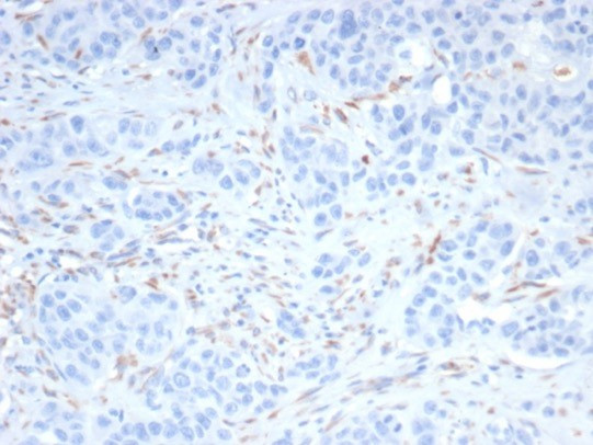 SALL-4 (Transcription Factor) Antibody in Immunohistochemistry (Paraffin) (IHC (P))