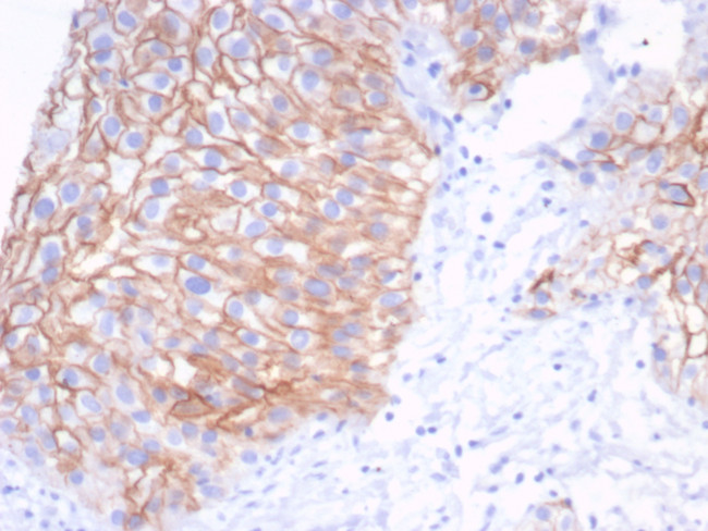 S100A14 (S100 calcium binding protein A14) Antibody in Immunohistochemistry (Paraffin) (IHC (P))