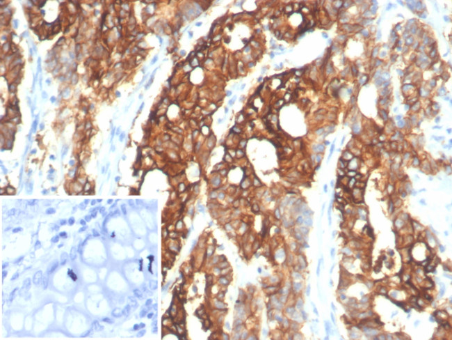 S100A14 (S100 calcium binding protein A14) Antibody in Immunohistochemistry (Paraffin) (IHC (P))