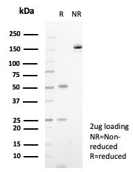 S100A14 (S100 calcium binding protein A14) Antibody in SDS-PAGE (SDS-PAGE)