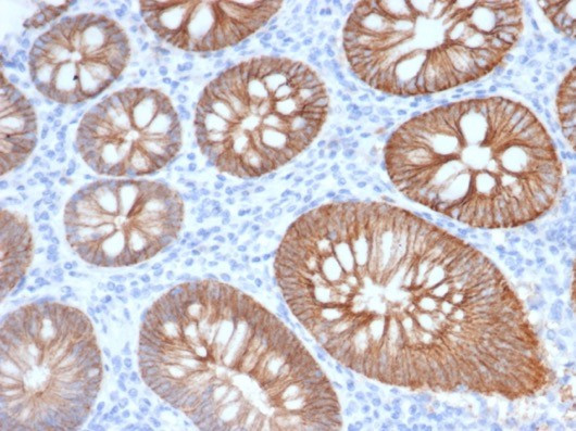 S100A14 (S100 calcium binding protein A14) Antibody in Immunohistochemistry (Paraffin) (IHC (P))