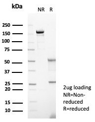 S100A14 (S100 calcium binding protein A14) Antibody in SDS-PAGE (SDS-PAGE)