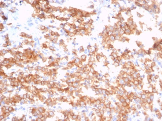 S100A14 (S100 calcium binding protein A14) Antibody in Immunohistochemistry (Paraffin) (IHC (P))