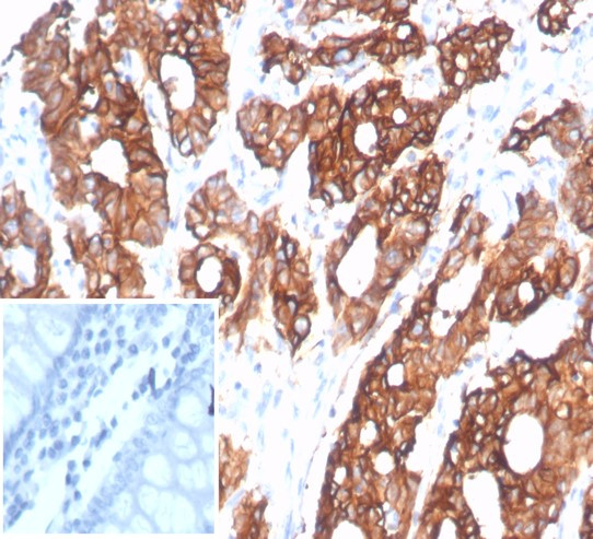 S100A14 (S100 calcium binding protein A14) Antibody in Immunohistochemistry (Paraffin) (IHC (P))