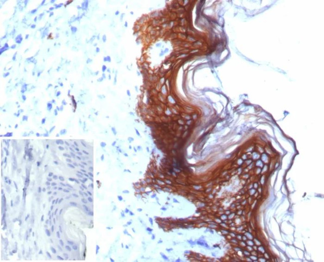 S100A14 (S100 calcium binding protein A14) Antibody in Immunohistochemistry (Paraffin) (IHC (P))