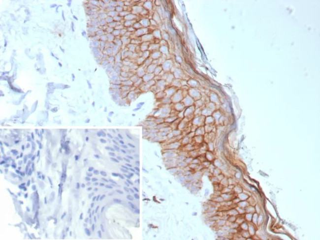 S100A14 (S100 calcium binding protein A14) Antibody in Immunohistochemistry (Paraffin) (IHC (P))