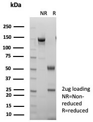 S100A14 (S100 calcium binding protein A14) Antibody in SDS-PAGE (SDS-PAGE)