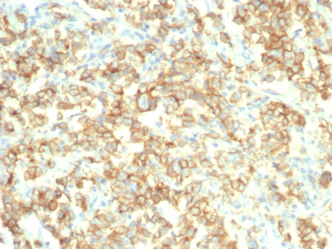 S100A14 (S100 calcium binding protein A14) Antibody in Immunohistochemistry (Paraffin) (IHC (P))