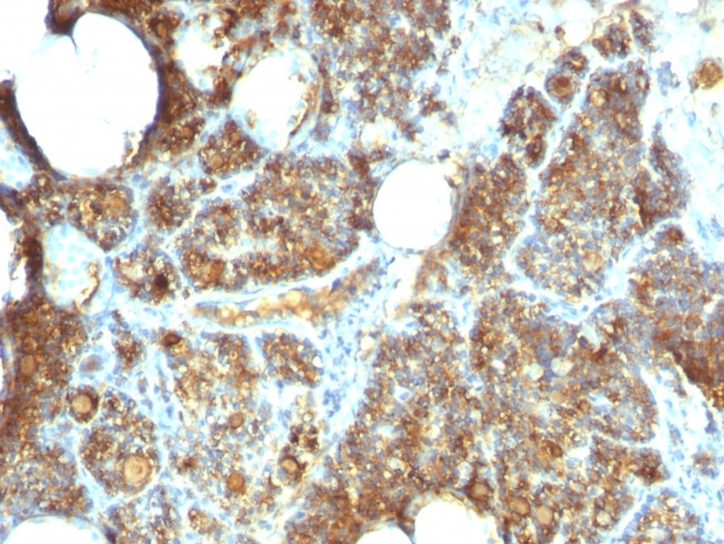 Parathyroid Hormone (PTH) Antibody in Immunohistochemistry (Paraffin) (IHC (P))